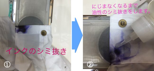 しみ抜きの流れ