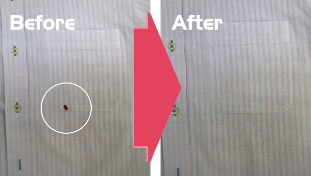 ワイシャツのしみ抜き