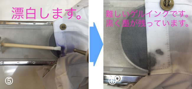 しみ抜きの流れ