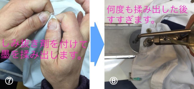 しみ抜きの流れ