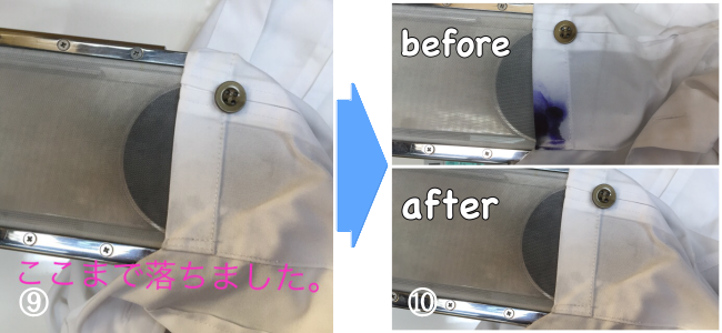 しみ抜きの流れ