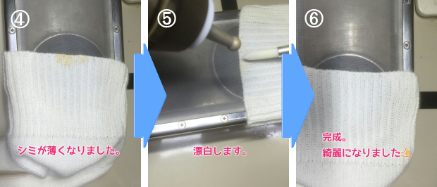 しみ抜きの流れ